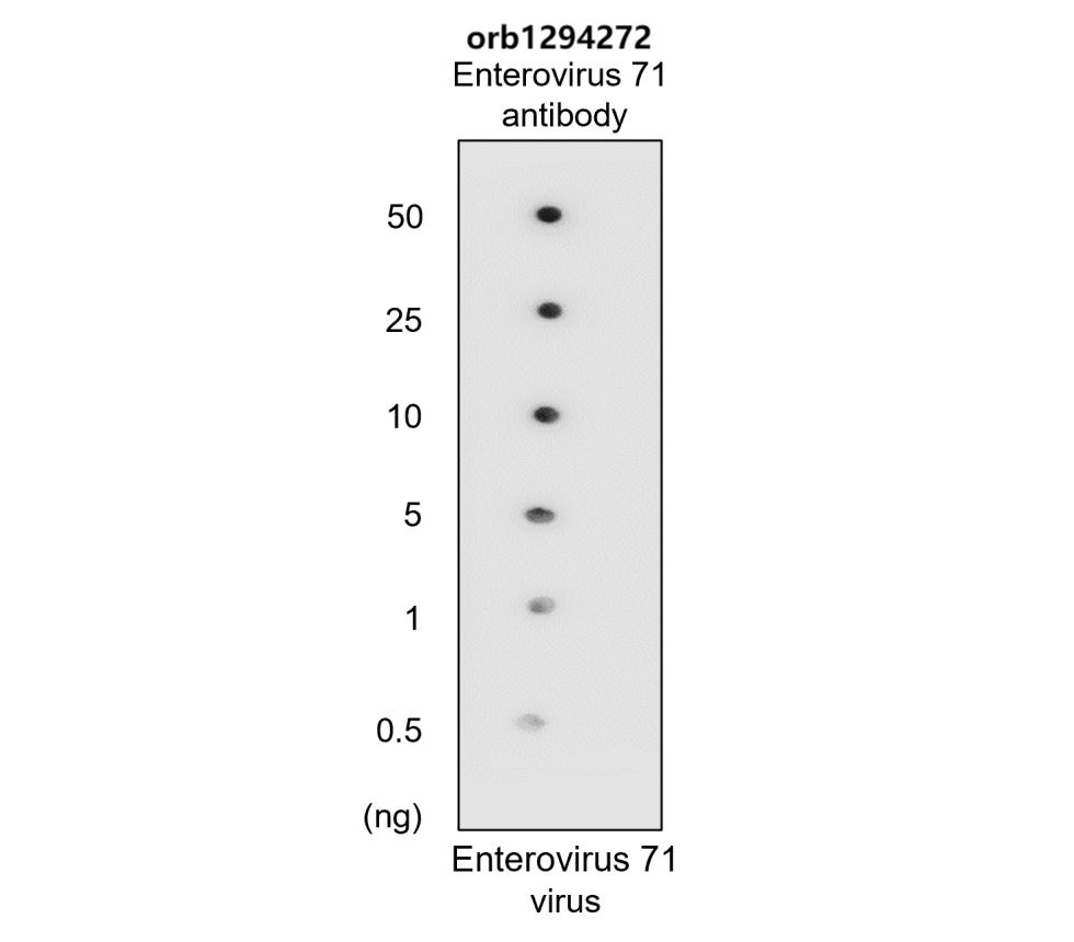 Enterovirus 71 antibody