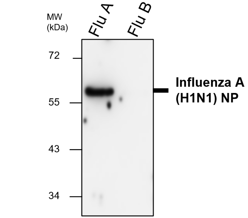 Influenza A Virus Nucleoprotein