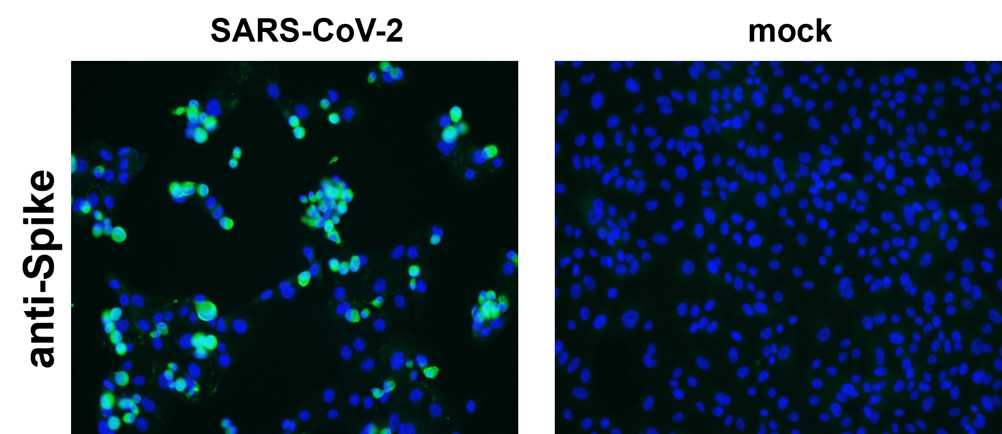 SARS-CoV-2 (COVID-19) Spike Antibody