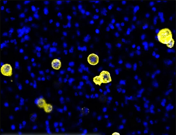 EGFR (Extracellular) Antibody