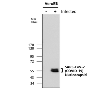 SARS-CoV-2 (COVID-19) nucleocapsid Antibody