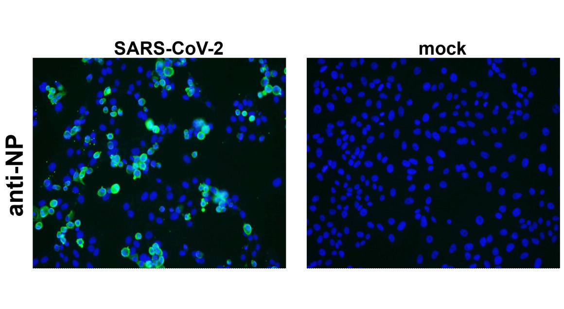 SARS-CoV-2 (COVID-19) nucleocapsid Antibody