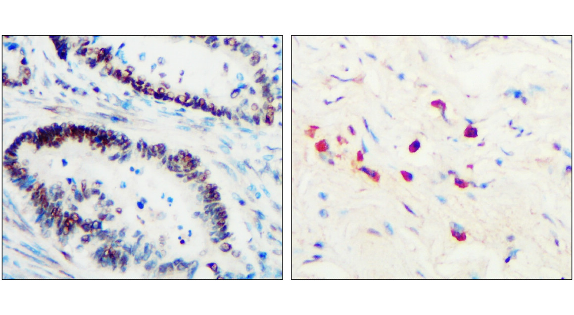 Toll-like Receptor 3 / TLR3