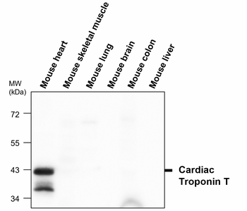 Troponin T, cardiac Antibody