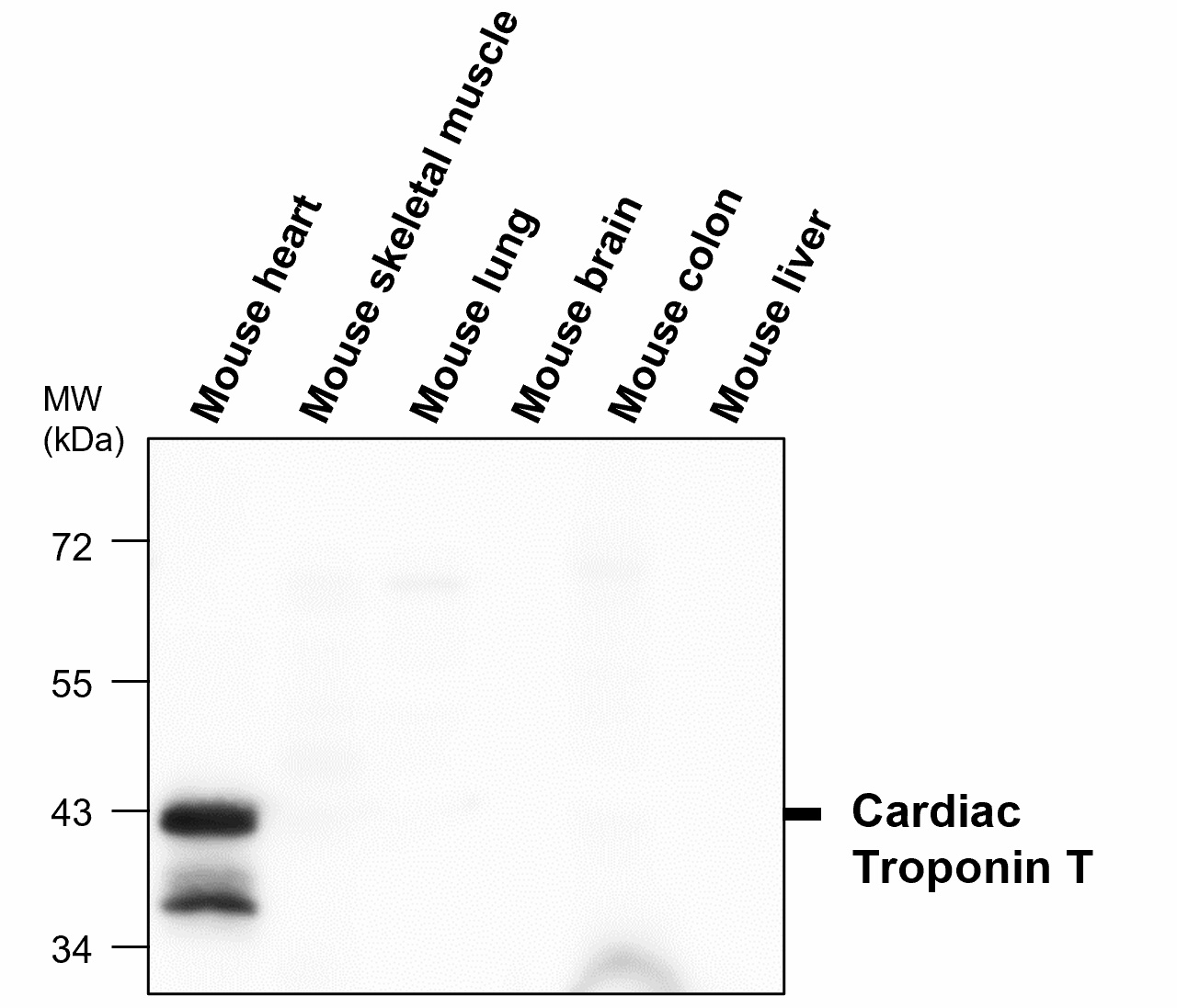 Troponin T, cardiac
