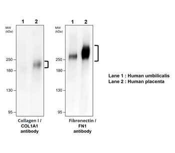 COL1A1/Collagen I Antibody