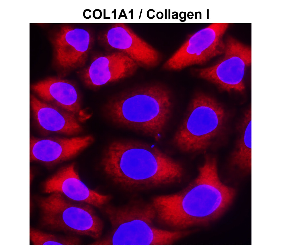 COL1A1 antibody