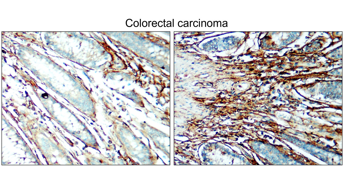 COL1A1 antibody