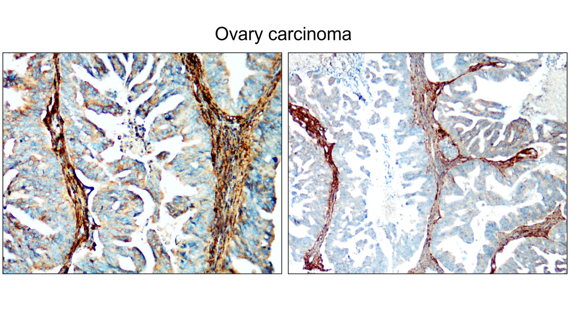 COL1A1 antibody