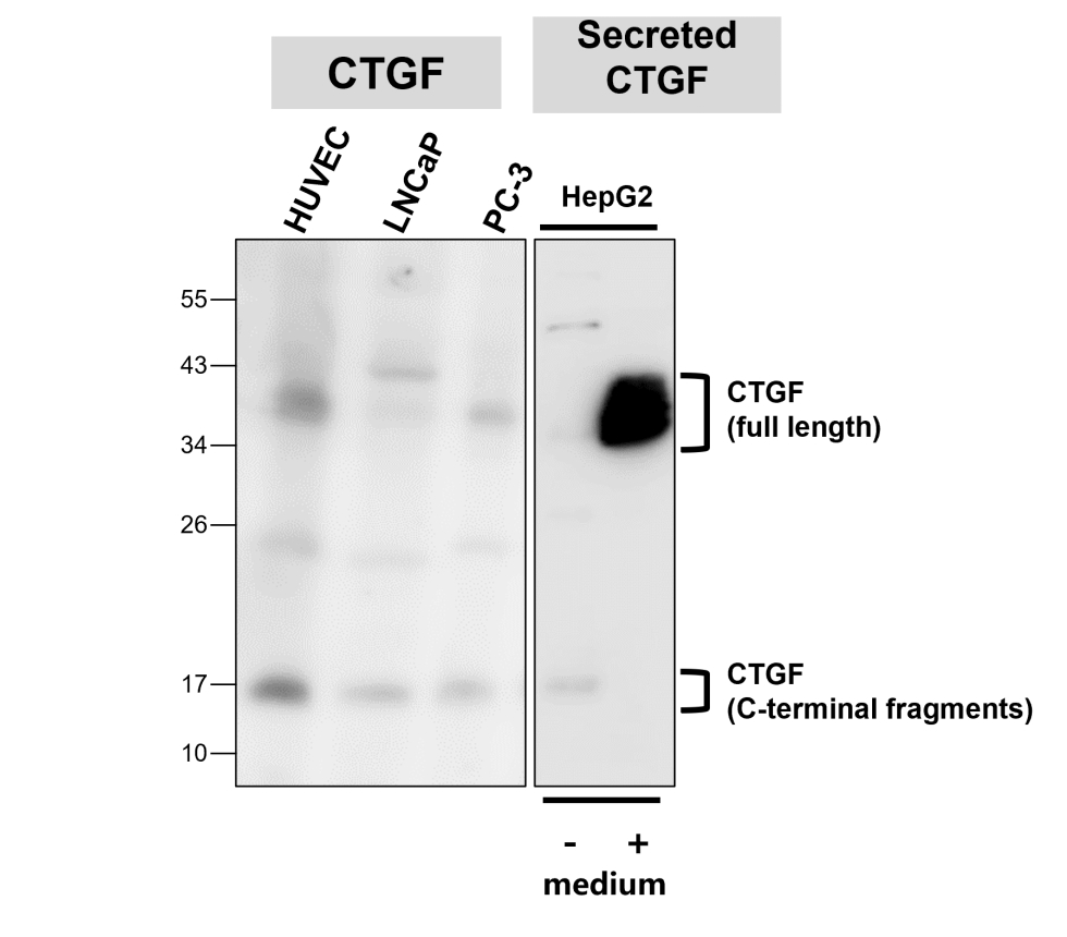 CTGF