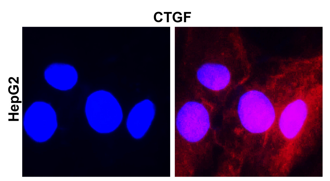 CTGF