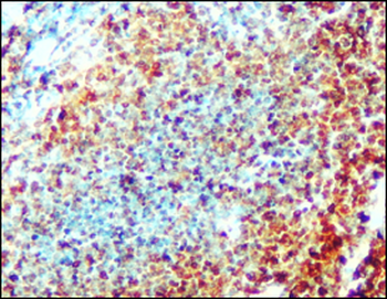 CD3 Antibody