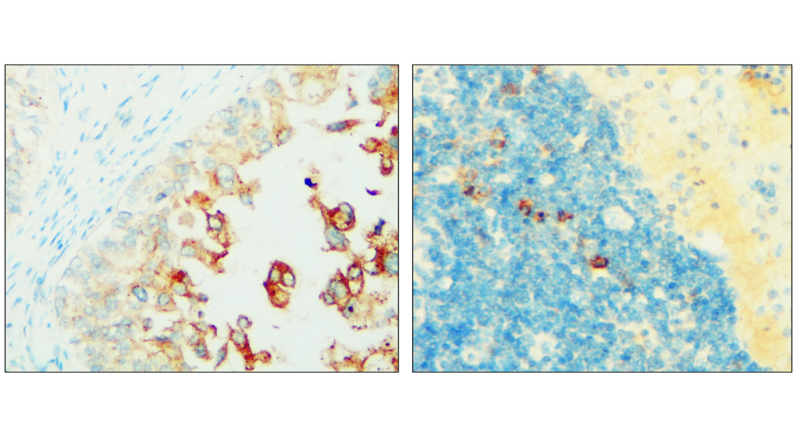 Syndecan-1 antibody