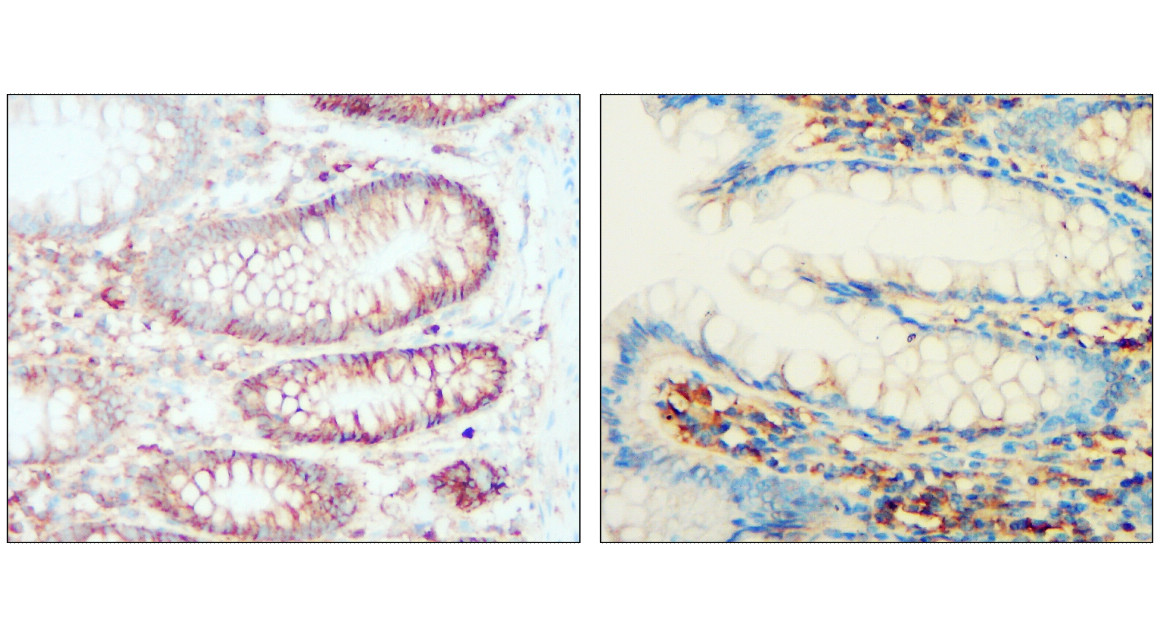 Syndecan-1 antibody