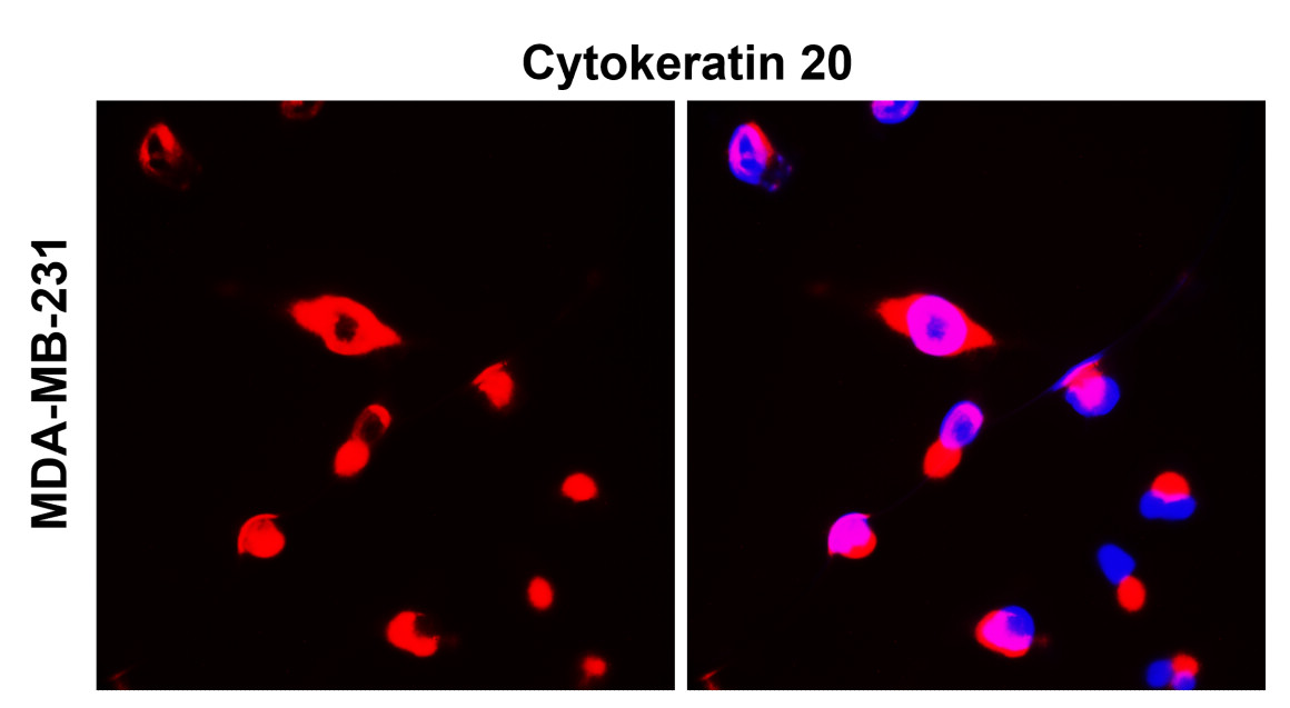 Cytokeratin 20, CK20 Antibody