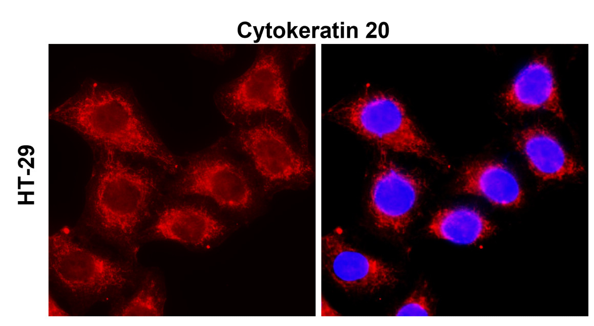 Cytokeratin 20, CK20 Antibody