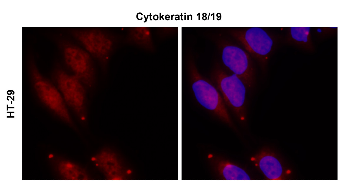 Cytokeratin 18/19, CK18/19
