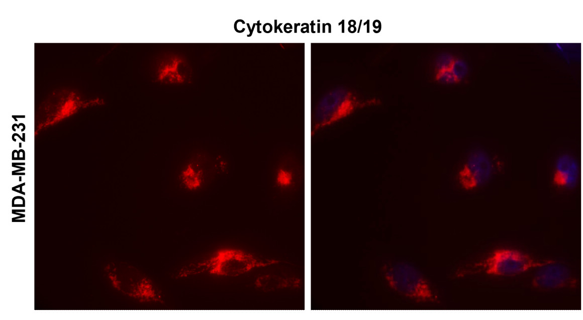 Cytokeratin 18 antibody