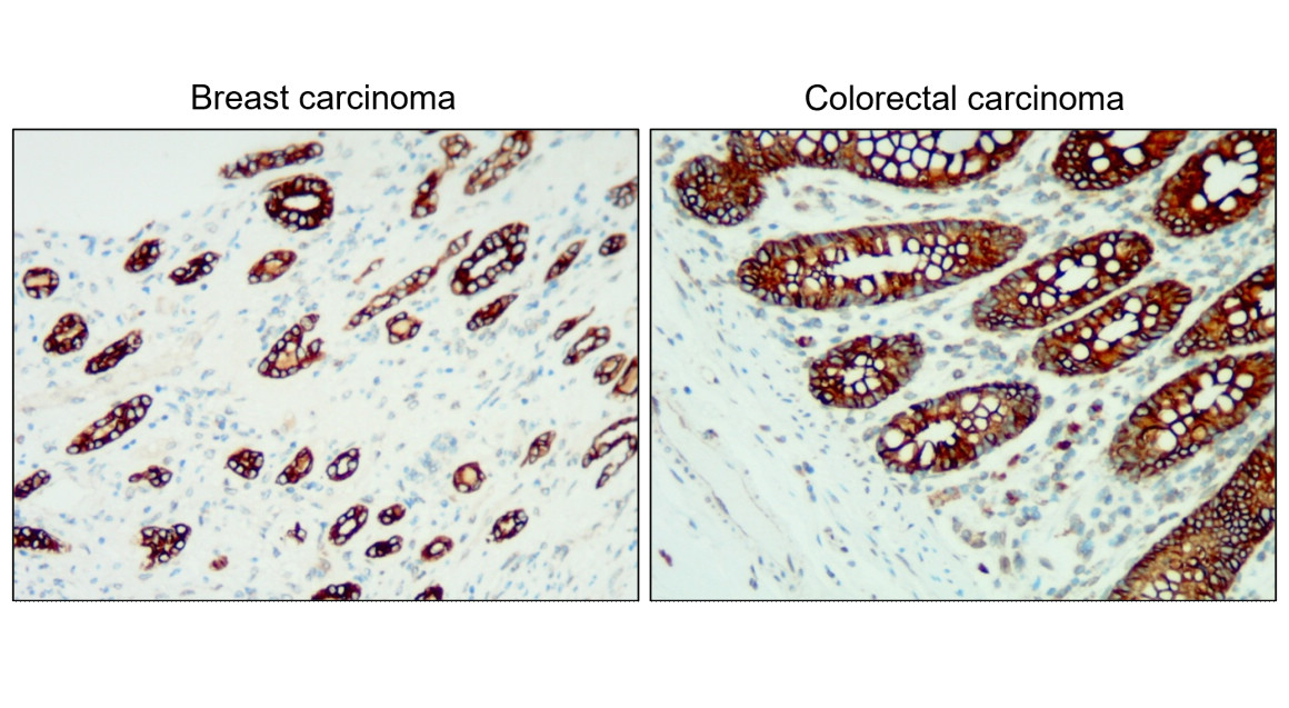 Cytokeratin 18/19, CK18/19