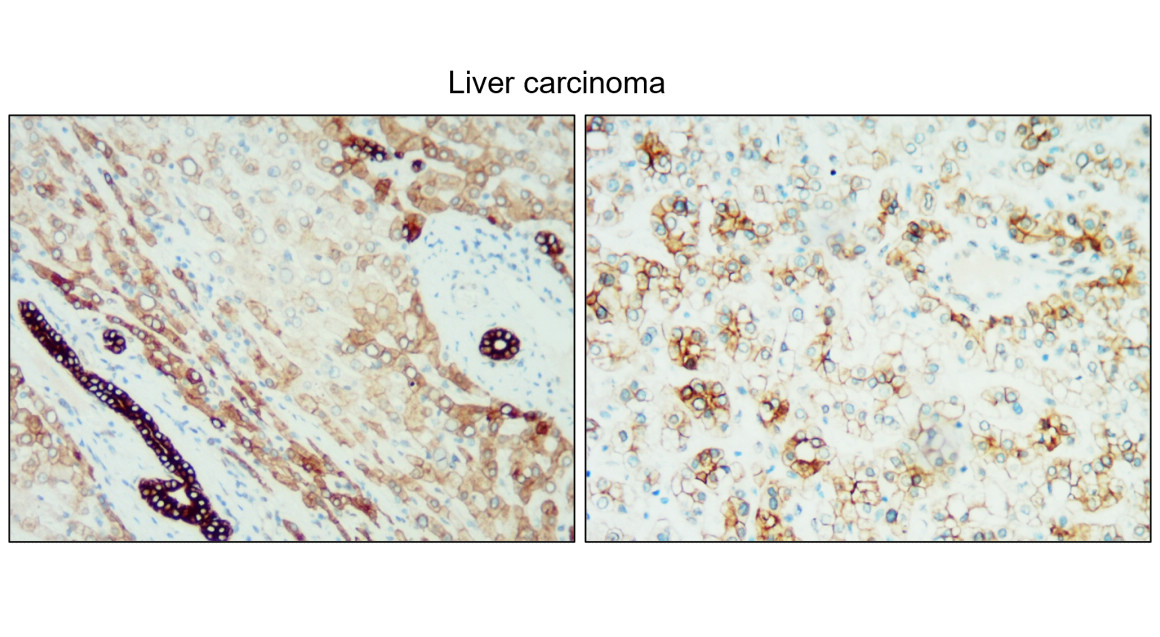 Cytokeratin 18 antibody