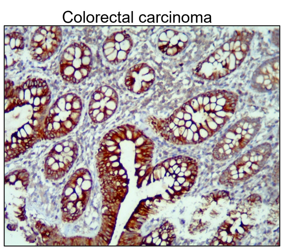 Cytokeratin 14 antibody