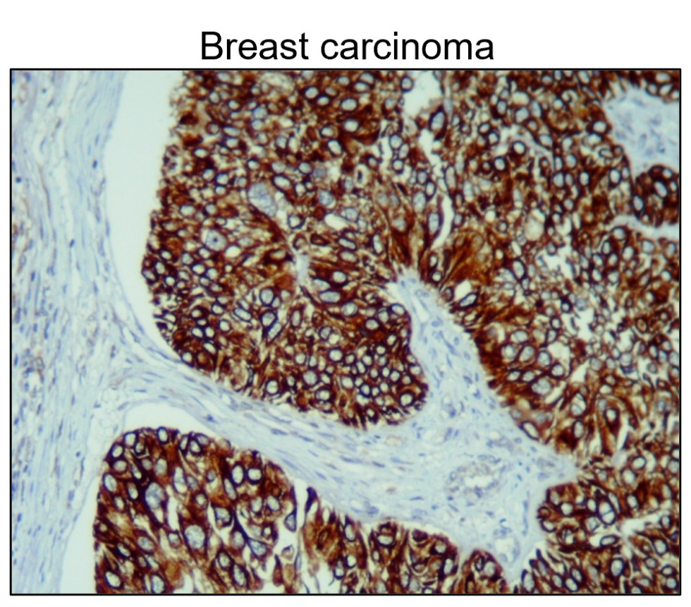 Cytokeratin 14 antibody