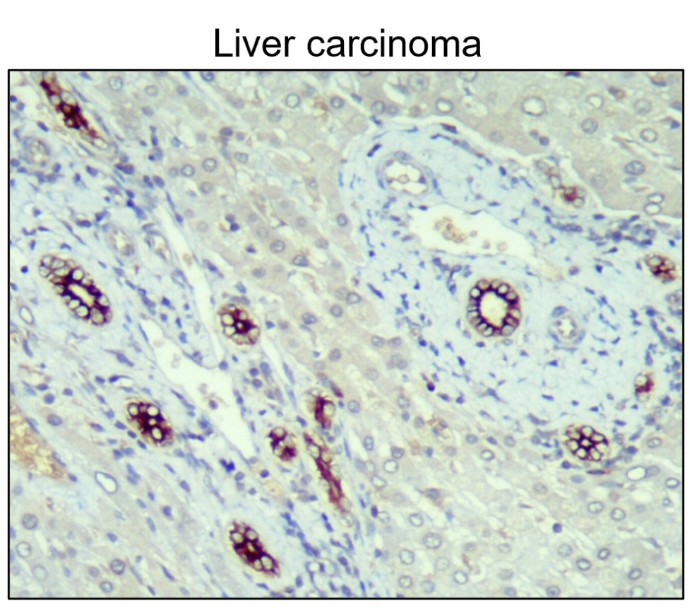 Cytokeratin 14 antibody