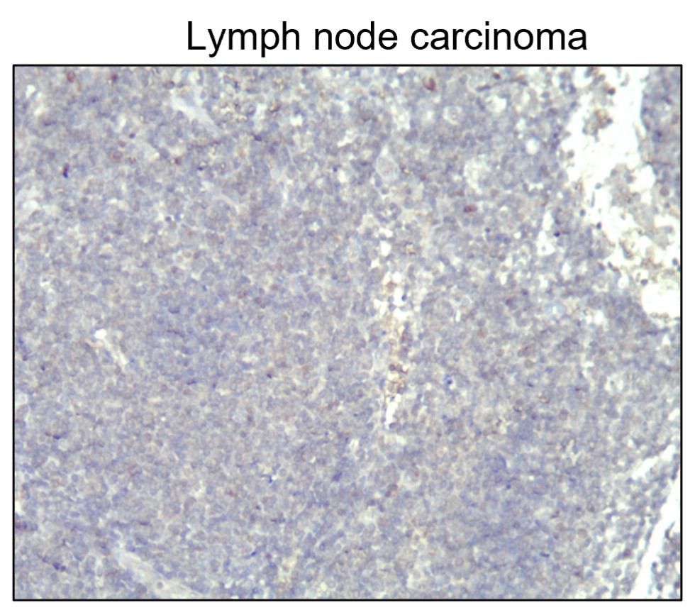 Cytokeratin 14 antibody