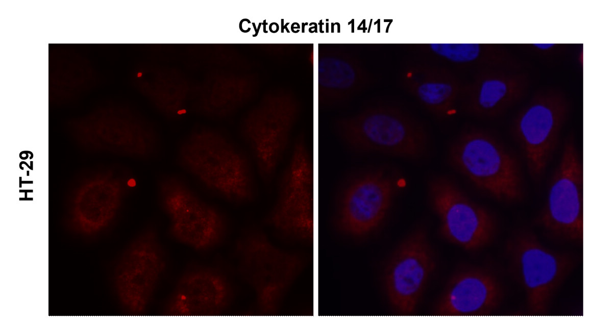 Cytokeratin 14 antibody