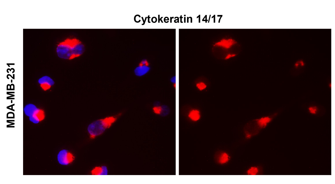 Cytokeratin 14 antibody