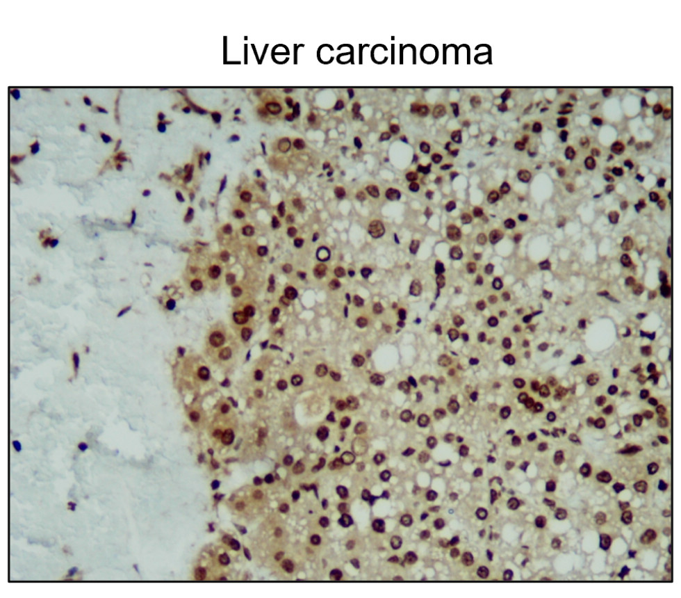 iNOS/NOS2 Antibody