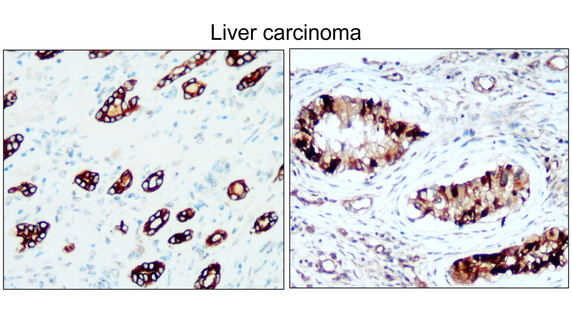 Cytokeratin 8, CK8