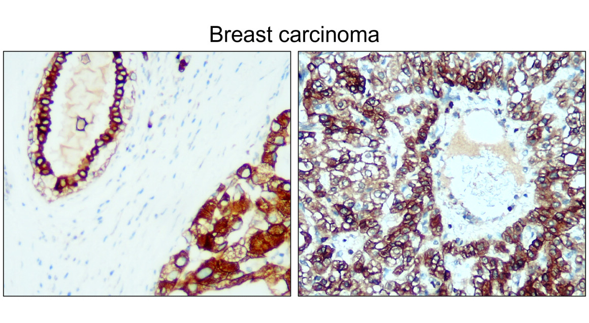 Cytokeratin 8, CK8