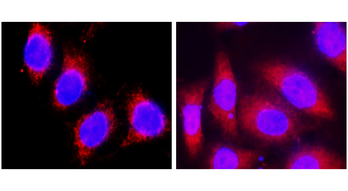Cytokeratin 8, CK8