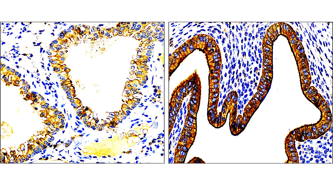 Cytokeratin 7, CK7