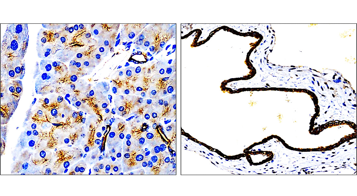 Cytokeratin 7, CK7