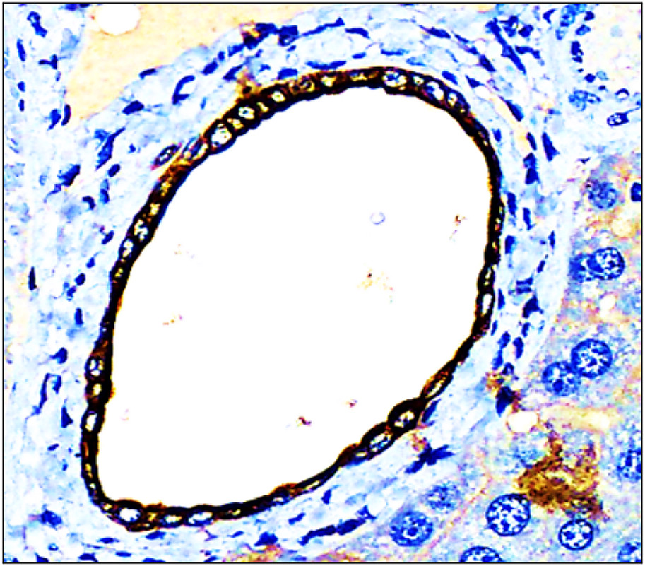 Cytokeratin 7, CK7