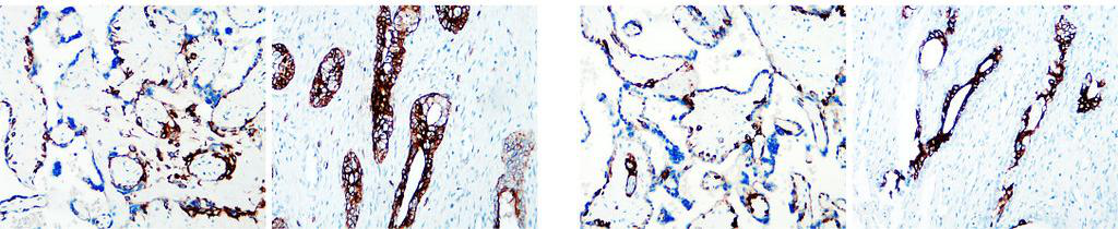 Cytokeratin 7, CK7