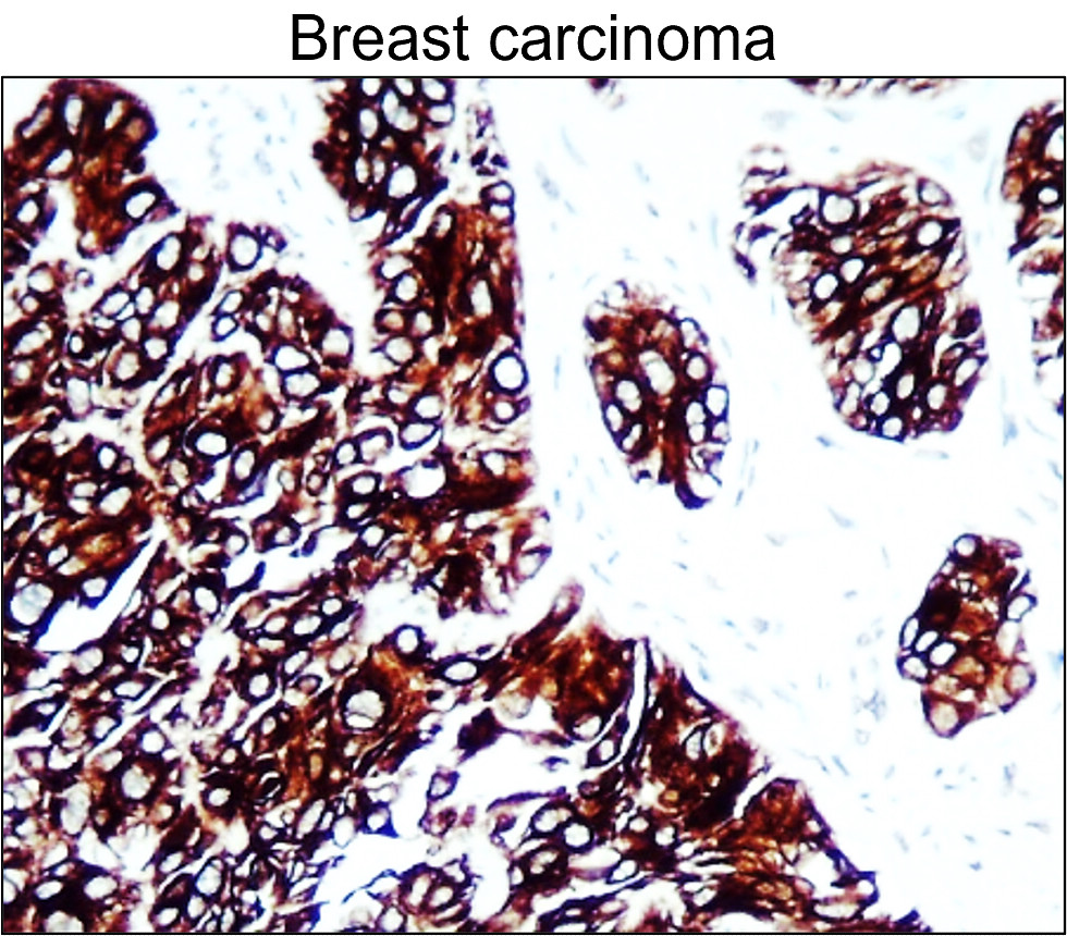 Cytokeratin 7, CK7