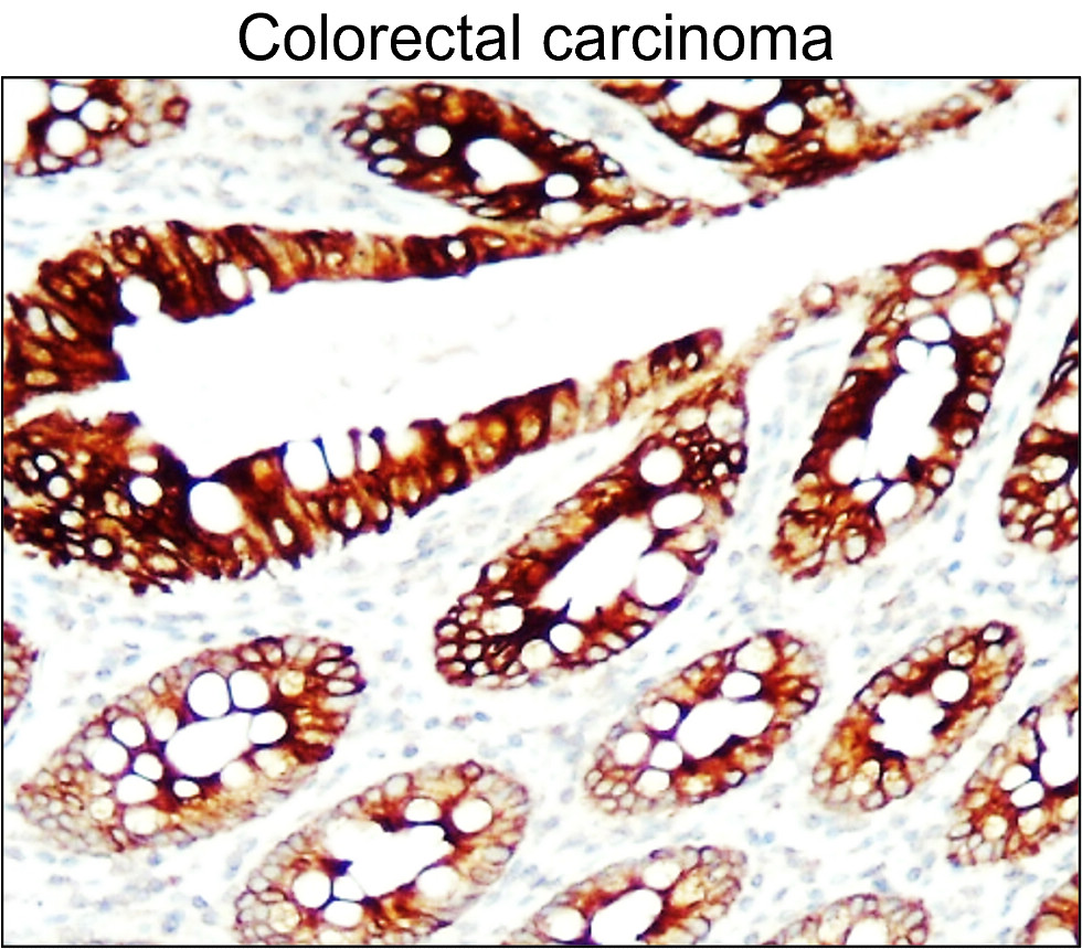 Cytokeratin 7, CK7