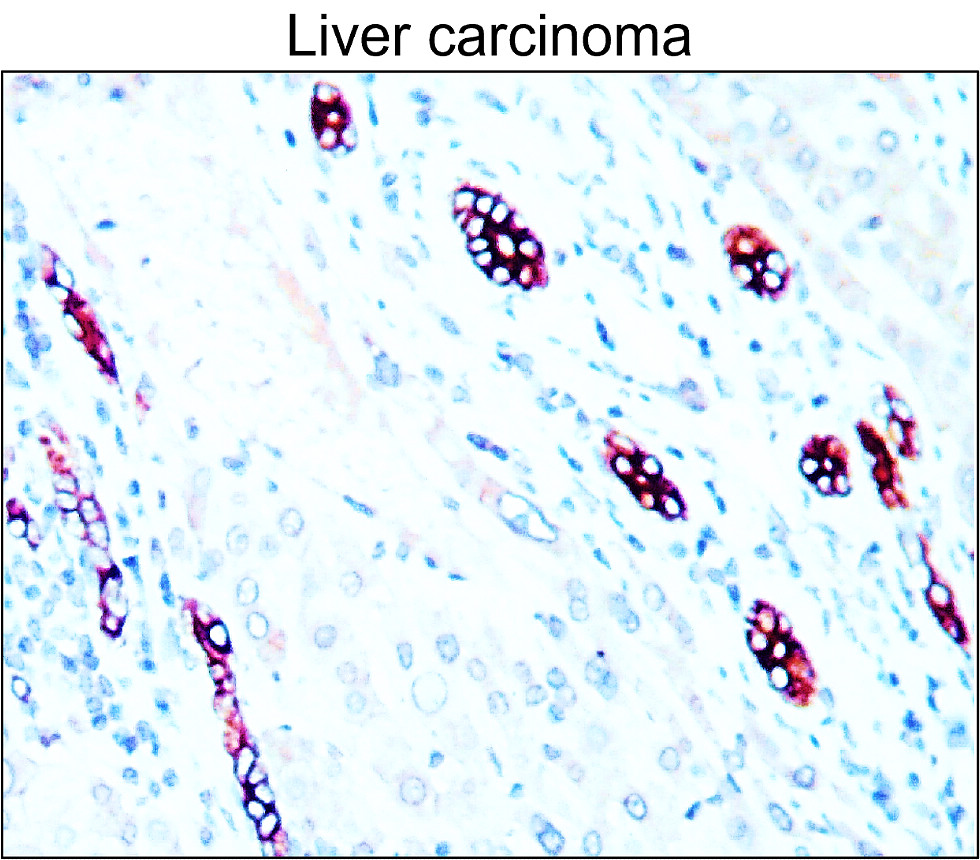 Cytokeratin 7, CK7