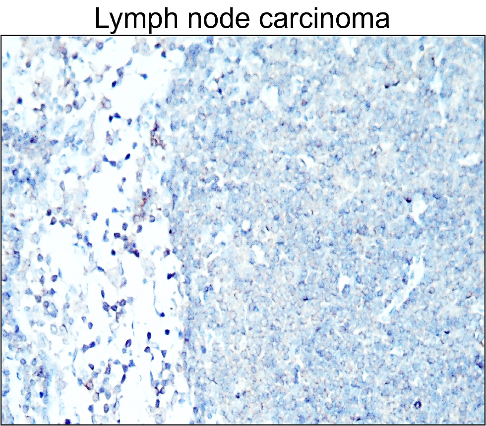 Cytokeratin 7, CK7