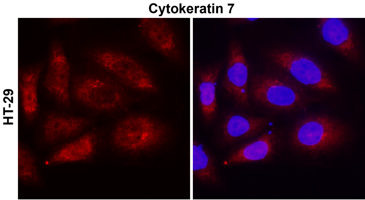 Cytokeratin 7, CK7