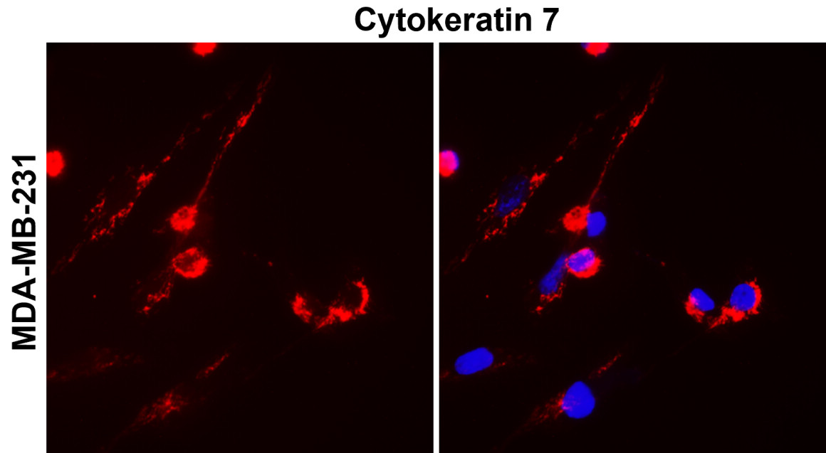 Cytokeratin 7, CK7