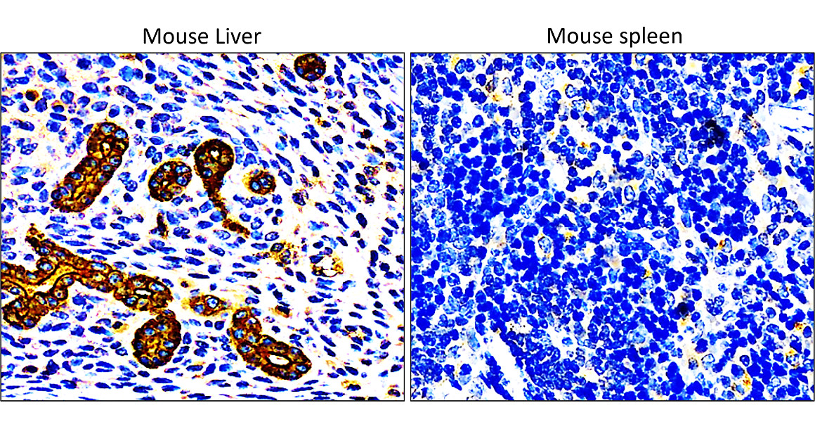 Cytokeratin 7, CK7
