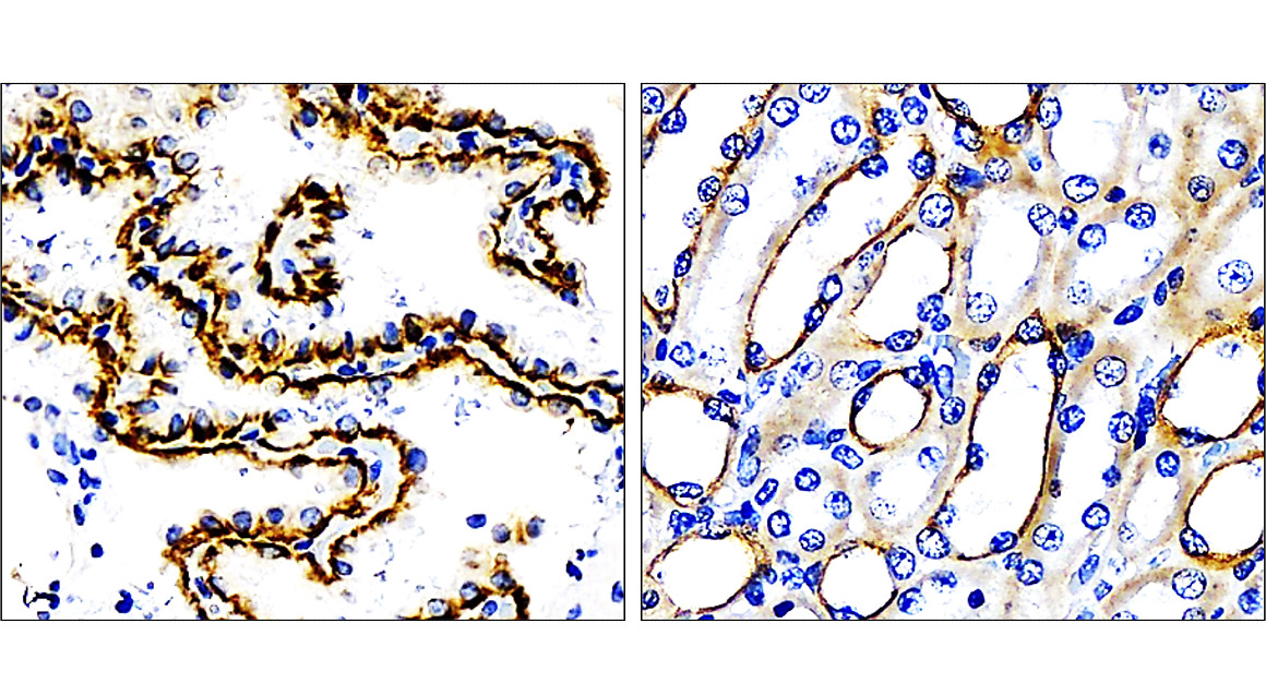 Cytokeratin 7, CK7