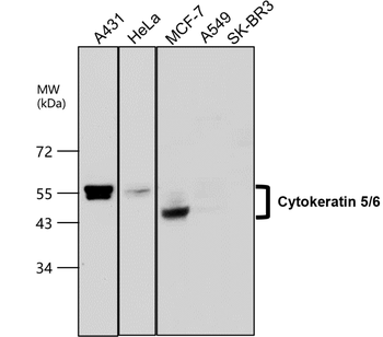 Cytokeratin 5/6, CK5/6 Antibody