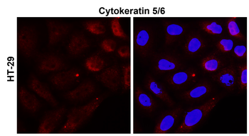 Cytokeratin 5/6, CK5/6 Antibody