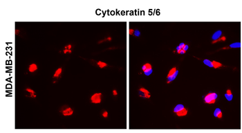 Cytokeratin 5/6, CK5/6 Antibody
