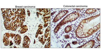 Cytokeratin 5/6, CK5/6 Antibody
